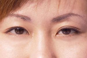 肌にハリを与えるのに適した美容液